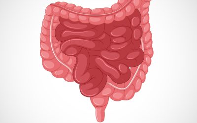 Síndrome de intestino irritable una enfermedad oscilante propia del adulto
