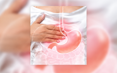 Enfermedad por reflujo gastroesofágico